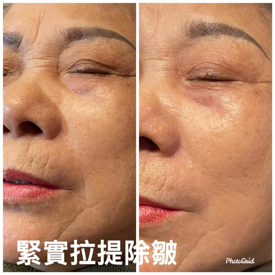 Client